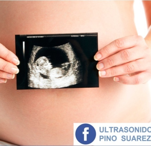 Описание изображения